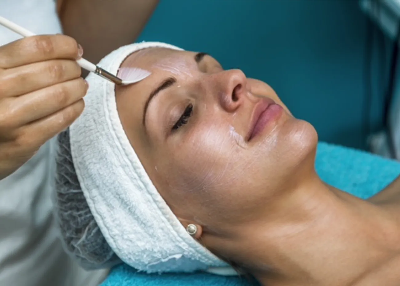 How much is a chemical peel?