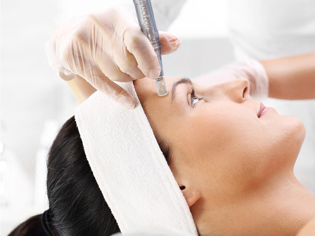 nano needling wilmington nc - coastal massage & spa